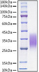 Recombinant Mouse CCL2/MCP-1 Protein (RP01607)