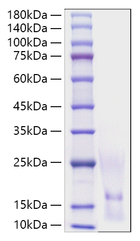 Recombinant Human CCL1/I-309 Protein