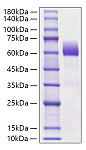 Recombinant Mouse CCL2/MCP-1 Protein (RP01622)