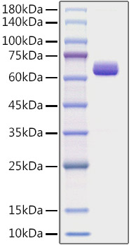 Recombinant Human Collagen I alpha 2/COL1A2 Protein