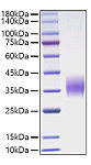 Recombinant Mouse Oncostatin-M/OSM Protein (RP01639)
