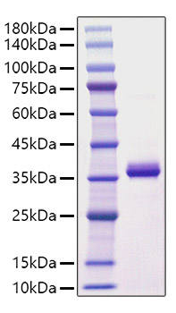 Recombinant Mouse CXCL10/IP10 Protein