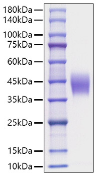 Recombinant Mouse IL4R Protein