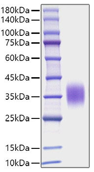 Recombinant Mouse IL-9 Protein