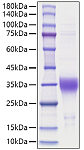 Recombinant Human Erythropoietin/EPO Protein (RP01690)