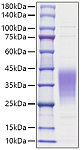 Recombinant Human Leukemia inhibitory factor/LIF Protein (RP01697)