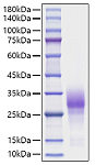 Recombinant Human TNFRSF9/4-1BB/CD137 Protein (RP01698)