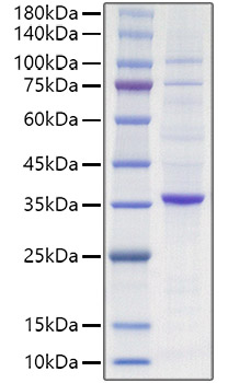 Recombinant Human Proliferating cell nuclear antigen/PCNA Protein