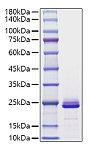 Recombinant Mouse FGF-21 Protein (RP01715)