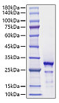 Recombinant Human HMGB2 Protein (RP01718)