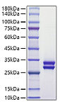 Recombinant Human Prolactin/PRL Protein (RP01723)