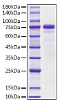 Recombinant Mouse E-Cadherin/Cadherin-1/CDH1 Protein (RP01727)