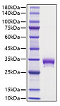 Recombinant Mouse EPO-R/Epor Protein (RP01732)