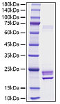 Recombinant Rat IL-1 alpha/Il1a Protein (RP01736)