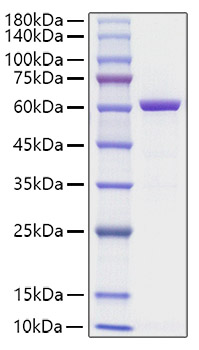Recombinant Human HMGB1-EGFP Protein