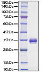 Recombinant Mouse Angiopoietin-1/ANG-1/ANGPT1 Protein (RP01743)