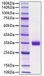 Recombinant Mouse Angiopoietin-2/ANG-2/ANGPT2 Protein (RP01744)