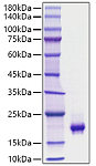 Active Recombinant Mouse PDGF-BB Protein (RP01745)
