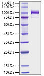 Recombinant Human Periostin/PN/POSTN Protein (RP01748)