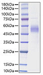 Recombinant Human IL-15 Protein (RP01751)