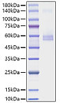Recombinant Mouse TNFSF13/APRIL/CD256 Protein (RP01753)