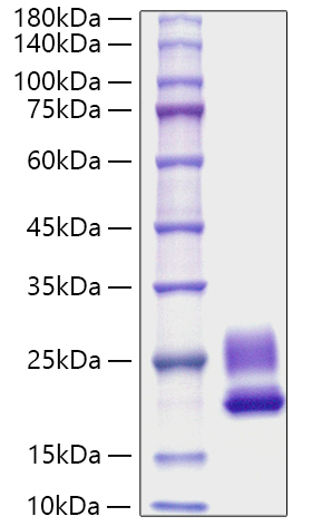 Recombinant Rat IL-21 Protein