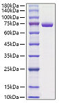 Recombinant Mouse Periostin/PN/POSTN Protein (RP01771)