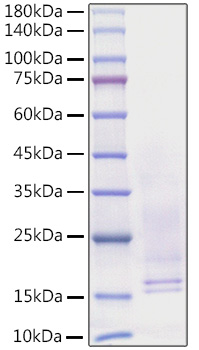 Recombinant Human Beta-NGF/NGF/NGFB Protein