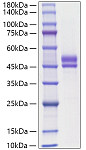 Recombinant Human WFDC2/HE4/WAP5 Protein (RP01798)