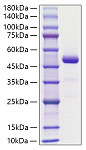 Recombinant Human RARRES2/TIG2 Protein (RP01808)