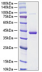 Recombinant Human RETN Protein (RP01810)