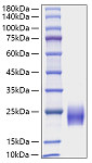 Recombinant Human FSH Beta Protein (RP01821)