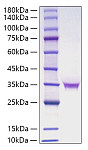Recombinant Human FGF-18 Protein (RP01827)