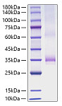 Recombinant Human Angiopoietin-1/ANG-1/ANGPT1 Protein (RP01828)