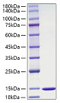 Recombinant Mouse Macrophage migration inhibitory factor/MIF Protein (RP01829)