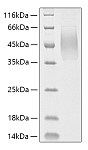 Recombinant Human MUC-16/CA125 Protein (RP01830)