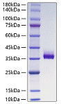 Recombinant Human Angiopoietin-like 3/ANGPTL3 Protein (RP01831)