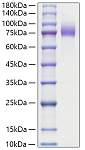 Recombinant Human MUC-16/CA125 Protein (RP01839)
