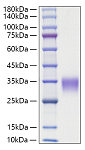 Recombinant Rat Oncostatin-M/OSM Protein (RP01844)