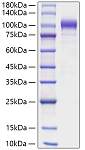 Recombinant Human Semaphorin-6A/SEMA6A Protein (RP01850)