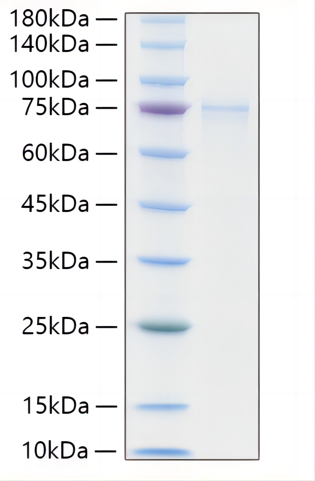 Recombinant Human MMP-2 Protein