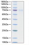 Recombinant Human MMP-2 Protein (RP01889)