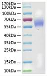 Recombinant Mouse Galectin-9/LGALS9 Protein (RP02002LQ)