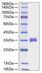 Recombinant Human Angiopoietin-2/ANGPT2 Protein (RP02008)
