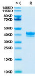 Recombinant Cynomolgus TNFRSF17/BCMA/CD269 Protein (RP02009)