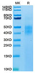 Biotinylated Recombinant Human NKG2-2A/KLRC1/CD159a Protein (RP02020)