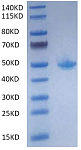 Recombinant Mouse FcRn Protein (RP02030)