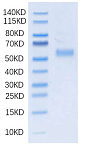 Recombinant Human DLL3 Protein (RP02041)