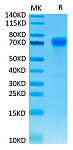 Recombinant Human B7-H1/PD-L1/CD274 Protein (RP02045)