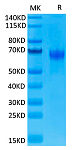 Recombinant Human PD-1/PDCD1/CD279 Protein (RP02046)
